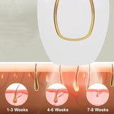 IPL Hair Removal (Women)